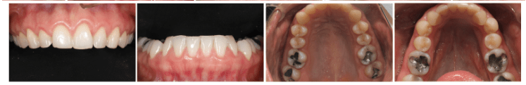 laboratorio dental cancun
