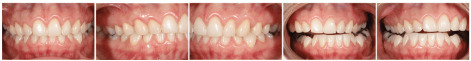 laboratorio dental cancun